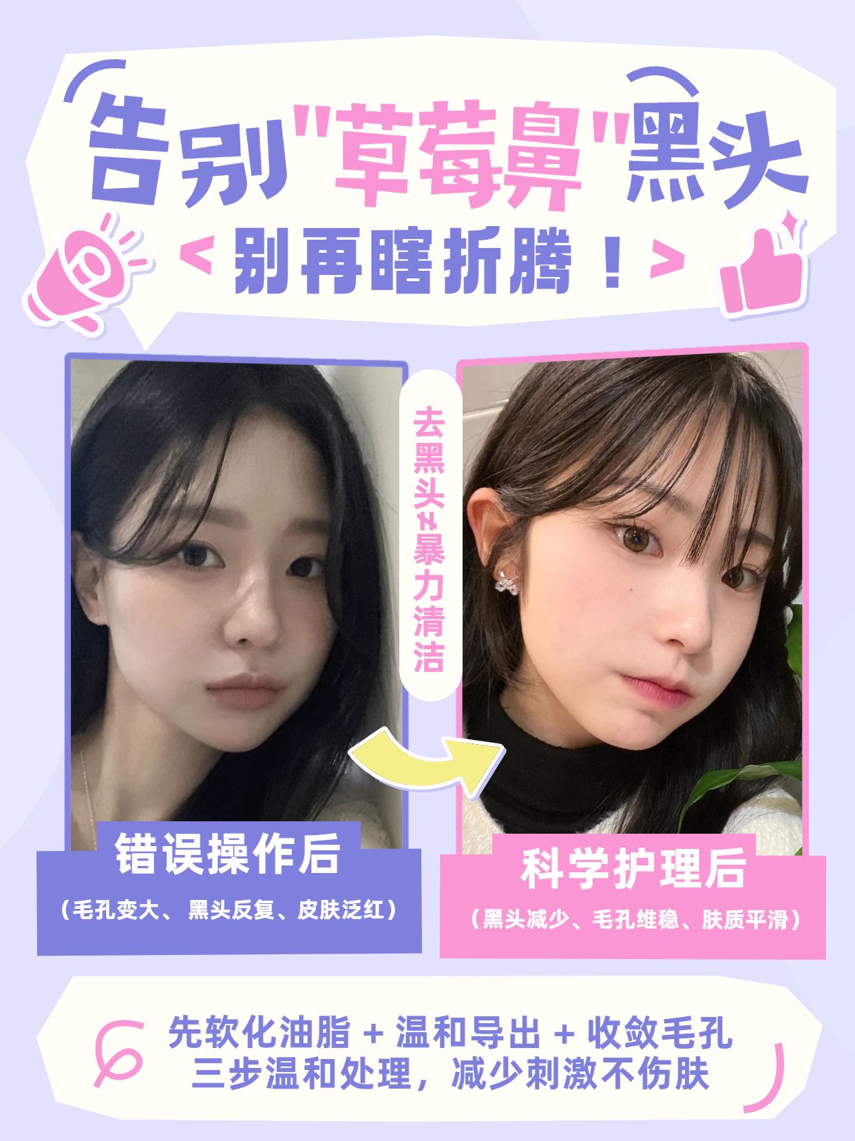 时尚风紫色粉色美妆护肤交流分享怎么科学去黑头小红书封面