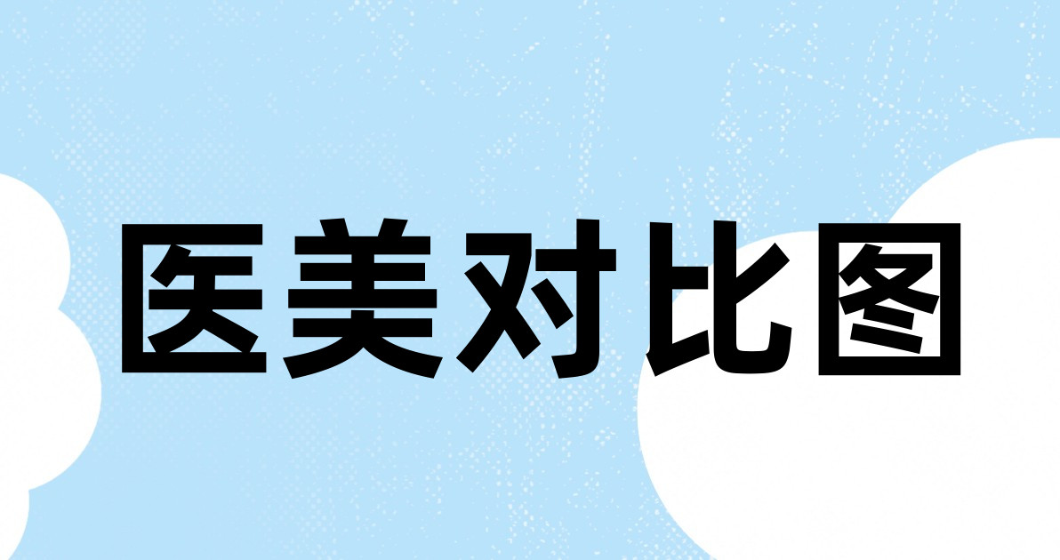 医美对比图